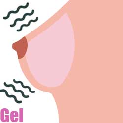 Gel-Filled