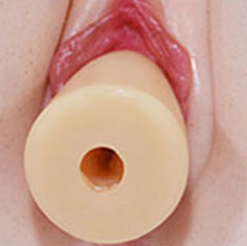 Removable